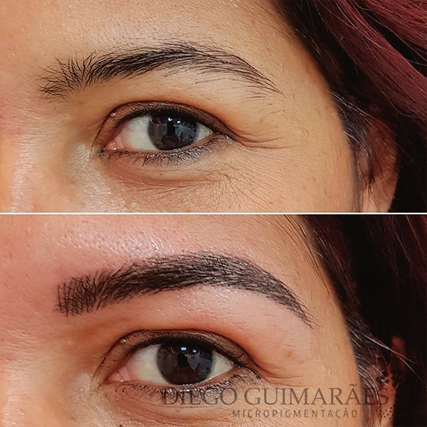 Quem ai gostou deste antes e depois? Realce a sua beleza você também, agende seu procedimento através do telefone (11) 2924-0957 Ou Whatsapp (11) 97985-7633.